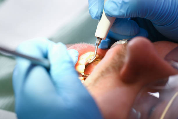 Best Emergency Dental Services for Seniors in Oak Hill, FL