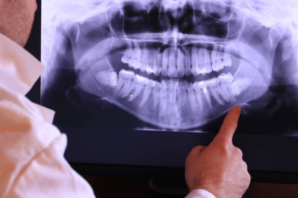 Best Emergency Root Canal Treatment in Oak Hill, FL