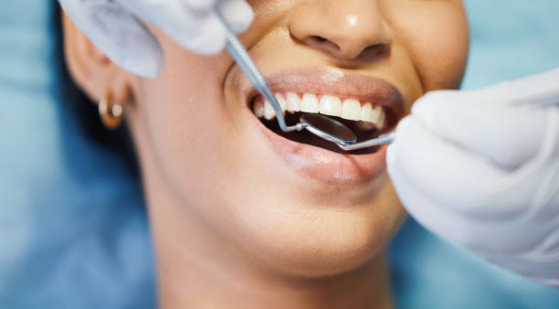 Best Broken or Cracked Tooth Emergency Dentist in Oak Hill, FL